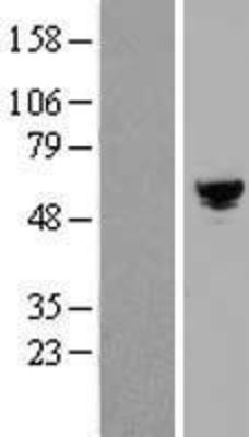 Western Blot: ARHGAP19 Overexpression Lysate (Adult Normal) [NBP2-05953] Left-Empty vector transfected control cell lysate (HEK293 cell lysate); Right -Over-expression Lysate for ARHGAP19.