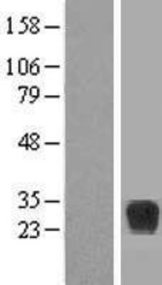 Western Blot: RND2 Overexpression Lysate (Adult Normal) [NBP2-07750] Left-Empty vector transfected control cell lysate (HEK293 cell lysate); Right -Over-expression Lysate for RND2.