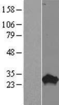 Western Blot: PROP1 Overexpression Lysate (Adult Normal) [NBP2-07650] Left-Empty vector transfected control cell lysate (HEK293 cell lysate); Right -Over-expression Lysate for PROP1.