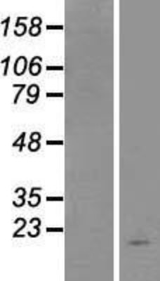 Western Blot: TSLP Overexpression Lysate (Adult Normal) [NBP2-05923] Left-Empty vector transfected control cell lysate (HEK293 cell lysate); Right -Over-expression Lysate for TSLP.