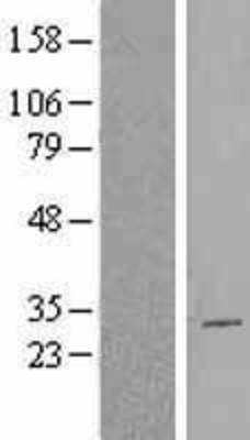 Western Blot: CBX2 Overexpression Lysate (Adult Normal) [NBL1-08747] Left-Empty vector transfected control cell lysate (HEK293 cell lysate); Right -Over-expression Lysate for CBX2.