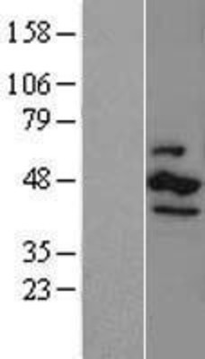 Western Blot: CSNK1E Overexpression Lysate (Adult Normal) [NBL1-09532] Left-Empty vector transfected control cell lysate (HEK293 cell lysate); Right -Over-expression Lysate for CSNK1E.