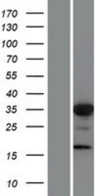 Western Blot: FOXL1 Overexpression Lysate (Adult Normal) [NBP2-07770] Left-Empty vector transfected control cell lysate (HEK293 cell lysate); Right -Over-expression Lysate for FOXL1.