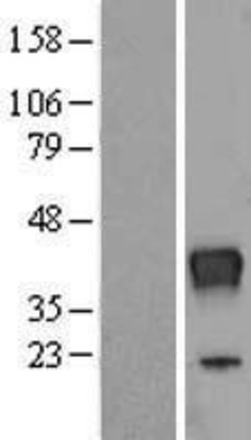 Western Blot: RNASET2 Overexpression Lysate (Adult Normal) [NBP2-07960] Left-Empty vector transfected control cell lysate (HEK293 cell lysate); Right -Over-expression Lysate for RNASET2.
