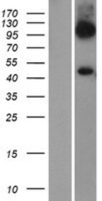 Western Blot: SLC7A6 Overexpression Lysate (Adult Normal) [NBP2-07929] Left-Empty vector transfected control cell lysate (HEK293 cell lysate); Right -Over-expression Lysate for SLC7A6.