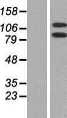 Western Blot: DHX16 Overexpression Lysate (Adult Normal) [NBP2-07977] Left-Empty vector transfected control cell lysate (HEK293 cell lysate); Right -Over-expression Lysate for DHX16.