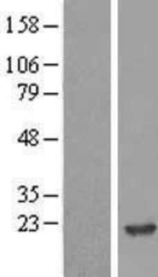 Western Blot: NME2 Overexpression Lysate (Adult Normal) [NBL1-13685] Left-Empty vector transfected control cell lysate (HEK293 cell lysate); Right -Over-expression Lysate for NME2.