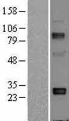 Western Blot: Adiponectin Overexpression Lysate (Adult Normal) [NBL1-07342] Left-Empty vector transfected control cell lysate (HEK293 cell lysate); Right -Over-expression Lysate for Adiponectin.