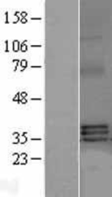 Western Blot: TNFSF13B Overexpression Lysate (Adult Normal) [NBL1-17166] Left-Empty vector transfected control cell lysate (HEK293 cell lysate); Right -Over-expression Lysate for TNFSF13B.