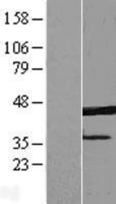 Western Blot: ERLIN1 Overexpression Lysate (Adult Normal) [NBP2-08262] Left-Empty vector transfected control cell lysate (HEK293 cell lysate); Right -Over-expression Lysate for ERLIN1.