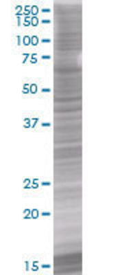 LRRC23 transfected lysate
