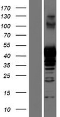 Western Blot: PRMT1 Overexpression Lysate (Adult Normal) [NBP2-08192] Left-Empty vector transfected control cell lysate (HEK293 cell lysate); Right -Over-expression Lysate for PRMT1.