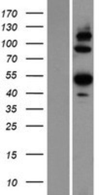 Western Blot: ANGPTL6 Overexpression Lysate (Adult Normal) [NBP2-06100] Left-Empty vector transfected control cell lysate (HEK293 cell lysate); Right -Over-expression Lysate for ANGPTL6.