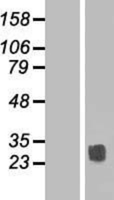 Western Blot: tetraspanin 14 Overexpression Lysate (Adult Normal) [NBP2-06157] Left-Empty vector transfected control cell lysate (HEK293 cell lysate); Right -Over-expression Lysate for tetraspanin 14.