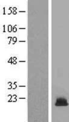 Western Blot: Histone H3 Overexpression Lysate (Adult Normal) [NBP2-06577] Left-Empty vector transfected control cell lysate (HEK293 cell lysate); Right -Over-expression Lysate for Histone H3.