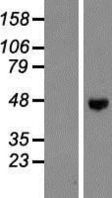 Western Blot: ENTPD5 Overexpression Lysate (Adult Normal) [NBP2-08223] Left-Empty vector transfected control cell lysate (HEK293 cell lysate); Right -Over-expression Lysate for ENTPD5.