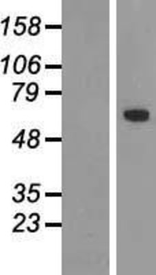 Western Blot: TBX18 Overexpression Lysate (Adult Normal) [NBP2-08401] Left-Empty vector transfected control cell lysate (HEK293 cell lysate); Right -Over-expression Lysate for TBX18.