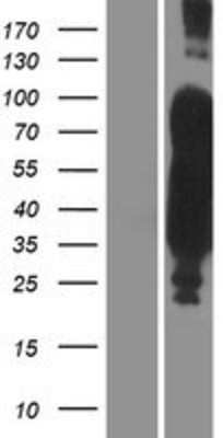 Western Blot: Tau Overexpression Lysate (Adult Normal) [NBP2-11394] Left-Empty vector transfected control cell lysate (HEK293 cell lysate); Right -Over-expression Lysate for Tau.
