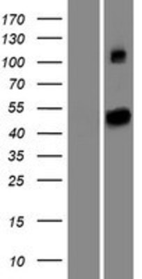 Western Blot: SETD6 Overexpression Lysate (Adult Normal) [NBP2-06275] Left-Empty vector transfected control cell lysate (HEK293 cell lysate); Right -Over-expression Lysate for SETD6.
