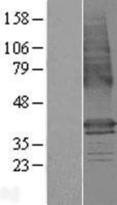 Western Blot: LMBR1 Overexpression Lysate (Adult Normal) [NBP2-06436] Left-Empty vector transfected control cell lysate (HEK293 cell lysate); Right -Over-expression Lysate for LMBR1.