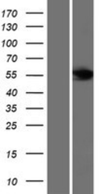 Western Blot: FBXL6 Overexpression Lysate (Adult Normal) [NBP2-06318] Left-Empty vector transfected control cell lysate (HEK293 cell lysate); Right -Over-expression Lysate for FBXL6.