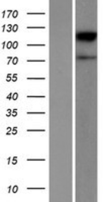 Western Blot: ACSBG2 Overexpression Lysate (Adult Normal) [NBP2-06163] Left-Empty vector transfected control cell lysate (HEK293 cell lysate); Right -Over-expression Lysate for ACSBG2.