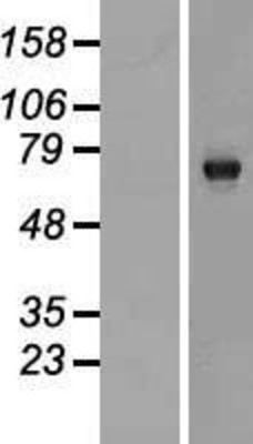 Western Blot: C13orf18 Overexpression Lysate (Adult Normal) [NBP2-06240] Left-Empty vector transfected control cell lysate (HEK293 cell lysate); Right -Over-expression Lysate for C13orf18.