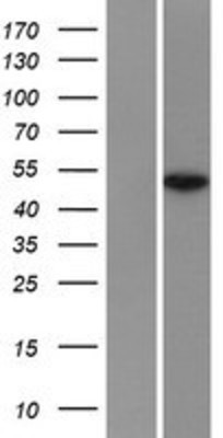 Western Blot: TCF7L2 Overexpression Lysate (Adult Normal) [NBP2-10147] Left-Empty vector transfected control cell lysate (HEK293 cell lysate); Right -Over-expression Lysate for TCF7L2.