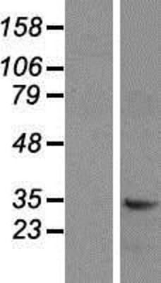 Western Blot: CD47 Overexpression Lysate (Adult Normal) [NBP2-10084] Left-Empty vector transfected control cell lysate (HEK293 cell lysate); Right -Over-expression Lysate for CD47.