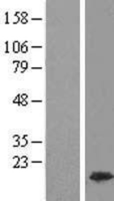 Western Blot: HMGA1 Overexpression Lysate (Adult Normal) [NBP2-09988] Left-Empty vector transfected control cell lysate (HEK293 cell lysate); Right -Over-expression Lysate for HMGA1.
