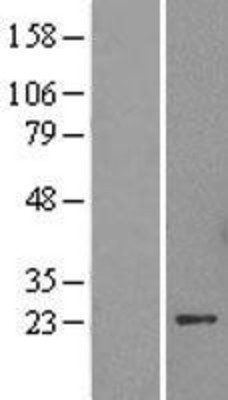 Western Blot: HP1 alpha Overexpression Lysate (Adult Normal) [NBP2-11379] Left-Empty vector transfected control cell lysate (HEK293 cell lysate); Right -Over-expression Lysate for HP1 alpha.