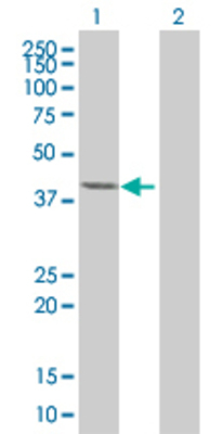 Lane 1: LRRC23 transfected lysate (37.84 KDa). Lane 2: Non-transfected lysate.
