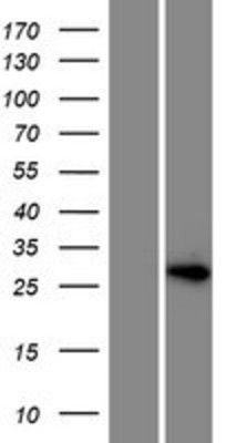 Western Blot: HOXD12 Overexpression Lysate (Adult Normal) [NBP2-06548] Left-Empty vector transfected control cell lysate (HEK293 cell lysate); Right -Over-expression Lysate for HOXD12.