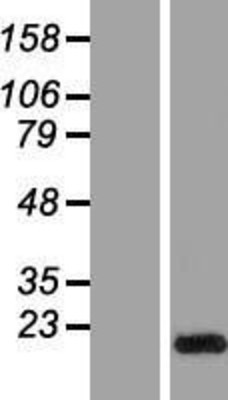 Western Blot: GLIPR2 Overexpression Lysate (Adult Normal) [NBP2-06449] Left-Empty vector transfected control cell lysate (HEK293 cell lysate); Right -Over-expression Lysate for GLIPR2.