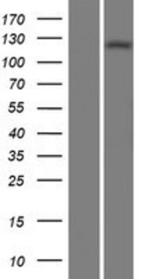 Western Blot: Adenylate Cyclase 1 Overexpression Lysate (Adult Normal) [NBP2-06564] Left-Empty vector transfected control cell lysate (HEK293 cell lysate); Right -Over-expression Lysate for Adenylate Cyclase 1.