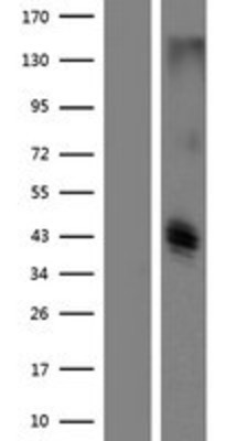 Western Blot: CLEC12B Overexpression Lysate (Adult Normal) [NBP2-09494] Left-Empty vector transfected control cell lysate (HEK293 cell lysate); Right -Over-expression Lysate for CLEC12B.