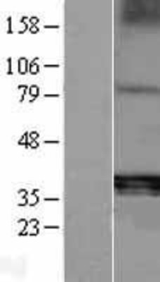 Western Blot: ACP5 Overexpression Lysate (Adult Normal) [NBP2-09378] Left-Empty vector transfected control cell lysate (HEK293 cell lysate); Right -Over-expression Lysate for ACP5.
