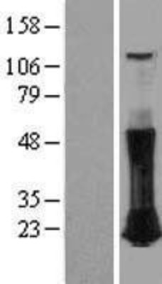 Western Blot: RhoC Overexpression Lysate (Adult Normal) [NBP2-09244] Left-Empty vector transfected control cell lysate (HEK293 cell lysate); Right -Over-expression Lysate for RhoC.