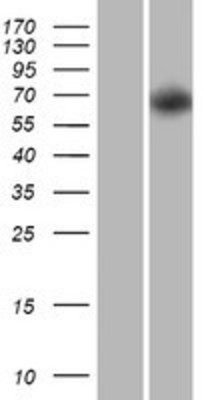 Western Blot: PRR5 Overexpression Lysate (Adult Normal) [NBP2-10236] Left-Empty vector transfected control cell lysate (HEK293 cell lysate); Right -Over-expression Lysate for PRR5.