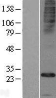 Western Blot: FAM26E Overexpression Lysate (Adult Normal) [NBP2-05231] Left-Empty vector transfected control cell lysate (HEK293 cell lysate); Right -Over-expression Lysate for FAM26E.