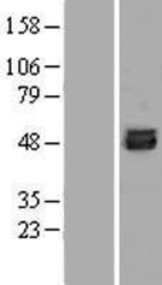 Western Blot: SKA3 Overexpression Lysate (Adult Normal) [NBP2-05508] Left-Empty vector transfected control cell lysate (HEK293 cell lysate); Right -Over-expression Lysate for SKA3.