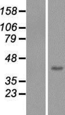 Western Blot: Fbl14 Overexpression Lysate (Adult Normal) [NBP2-05369] Left-Empty vector transfected control cell lysate (HEK293 cell lysate); Right -Over-expression Lysate for Fbl14.