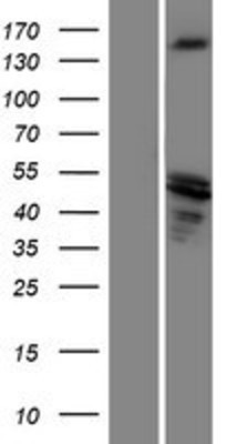 Western Blot: SRC1 Overexpression Lysate (Adult Normal) [NBP2-05443] Left-Empty vector transfected control cell lysate (HEK293 cell lysate); Right -Over-expression Lysate for SRC1.