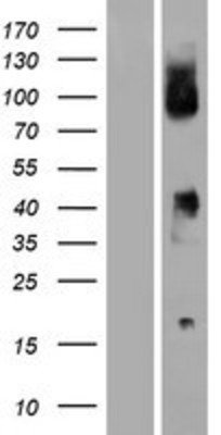 Western Blot: CD64 Overexpression Lysate (Adult Normal) [NBP2-10606] Left-Empty vector transfected control cell lysate (HEK293 cell lysate); Right -Over-expression Lysate for CD64.