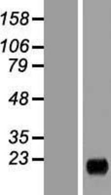 Western Blot: MARCH2 Overexpression Lysate (Adult Normal) [NBP2-10746] Left-Empty vector transfected control cell lysate (HEK293 cell lysate); Right -Over-expression Lysate for MARCH2.