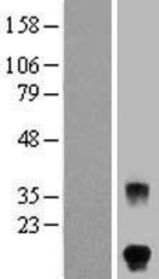 Western Blot: FSH beta Overexpression Lysate (Adult Normal) [NBP2-10680] Left-Empty vector transfected control cell lysate (HEK293 cell lysate); Right -Over-expression Lysate for FSH beta.