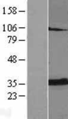 Western Blot: Adenine Nucleotide Translocator 2 Overexpression Lysate (Adult Normal) [NBL1-16073] Left-Empty vector transfected control cell lysate (HEK293 cell lysate); Right -Over-expression Lysate for Adenine Nucleotide Translocator 2.