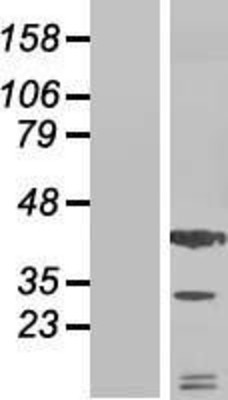 Western Blot: SDF1 Overexpression Lysate (Adult Normal) [NBP2-10687] Left-Empty vector transfected control cell lysate (HEK293 cell lysate); Right -Over-expression Lysate for SDF1.