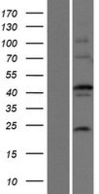 Western Blot: EFCBP2 Overexpression Lysate (Adult Normal) [NBP2-06727] Left-Empty vector transfected control cell lysate (HEK293 cell lysate); Right -Over-expression Lysate for EFCBP2.