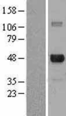 Western Blot: E2F4 Overexpression Lysate (Adult Normal) [NBL1-10085] Left-Empty vector transfected control cell lysate (HEK293 cell lysate); Right -Over-expression Lysate for E2F4.